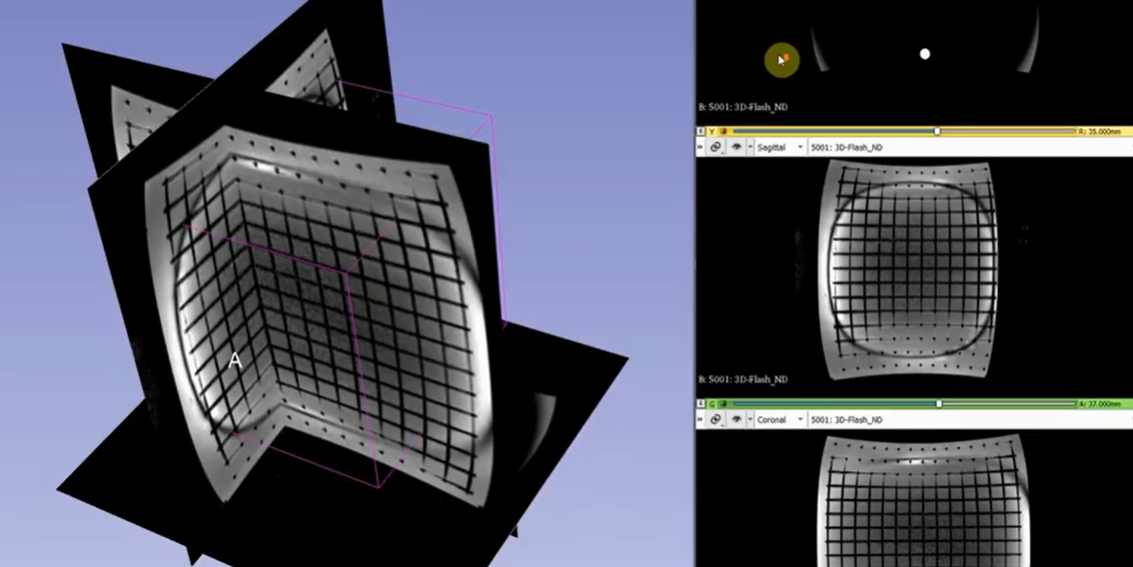 黃金標(biāo)準(zhǔn)X射線乳腺攝影對(duì)比度細(xì)節(jié)模體CDMAM 3.4